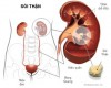Cập nhật về điều trị nội khoa và phòng ngừa sỏi thận