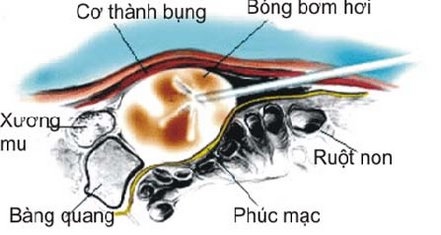 27 11 custom size 444 235