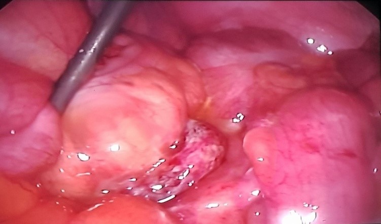 hình ảnh trong mổ