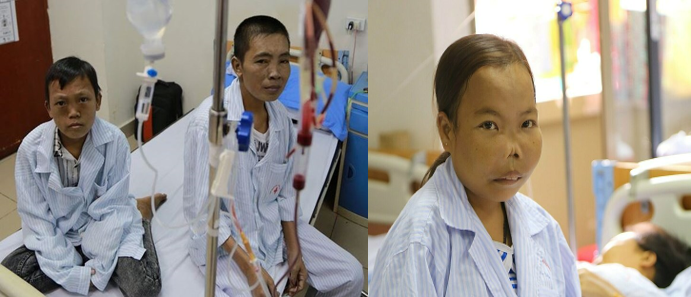 Hình 1. Các bệnh nhân mắc bệnh tan máu bẩm sinh đang điều trị tại Viện Huyết học-Truyền máu Trung ương. 