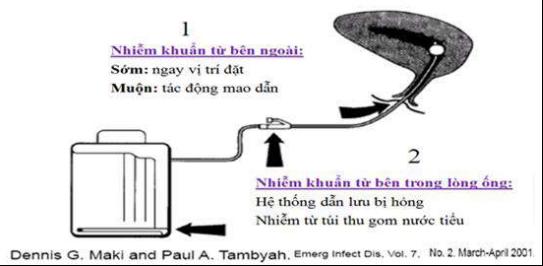 Đường xâm nhập của vi khuẩn gây nhiễm khuẩn tiết niệu