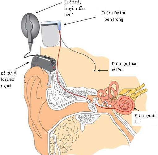 image 20221013103122 3