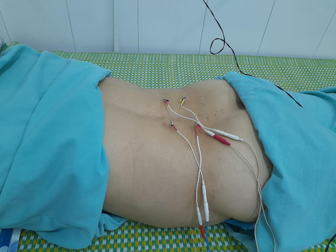 Bệnh thoái hóa cột sống thắt lưng