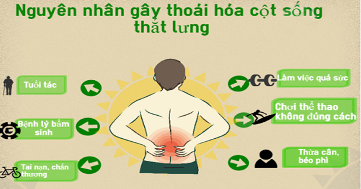 Bệnh thoái hóa cột sống thắt lưng