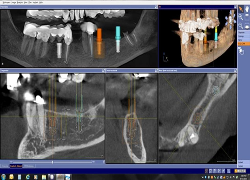 Cone Beam Ct & Những Ứng Dụng Trong Chuyên Ngành RHM