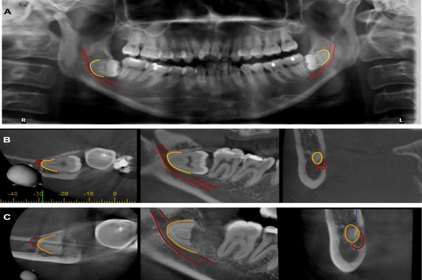 Cone Beam Ct & Những Ứng Dụng Trong Chuyên Ngành RHM