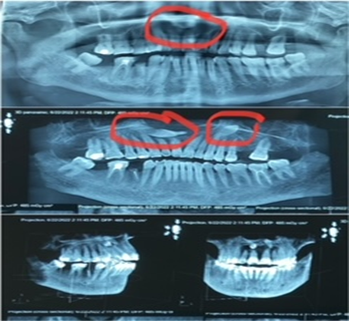 Cone Beam Ct & Những Ứng Dụng Trong Chuyên Ngành RHM