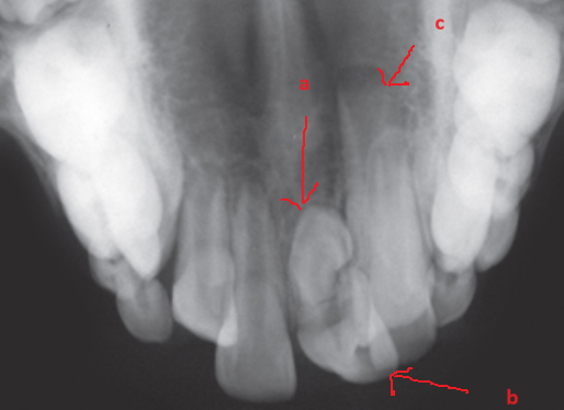 image 20231218155055 16 514x374