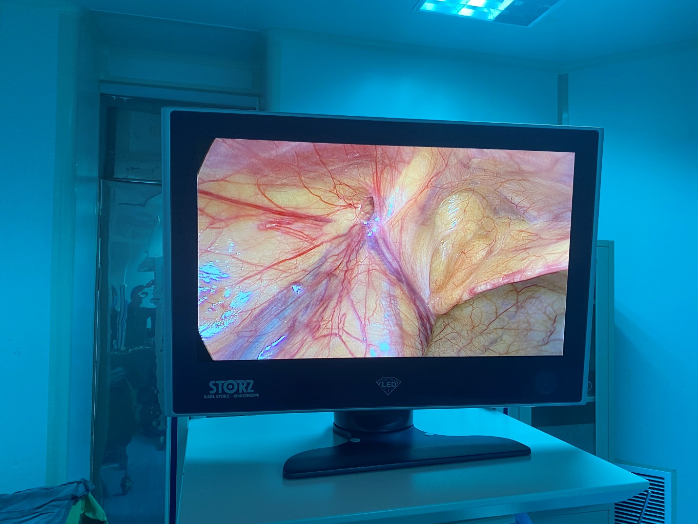 (Bệnh nhân được phẫu thuật tại khoa Ngoại tổng hợp – BVĐK Quảng Trị)